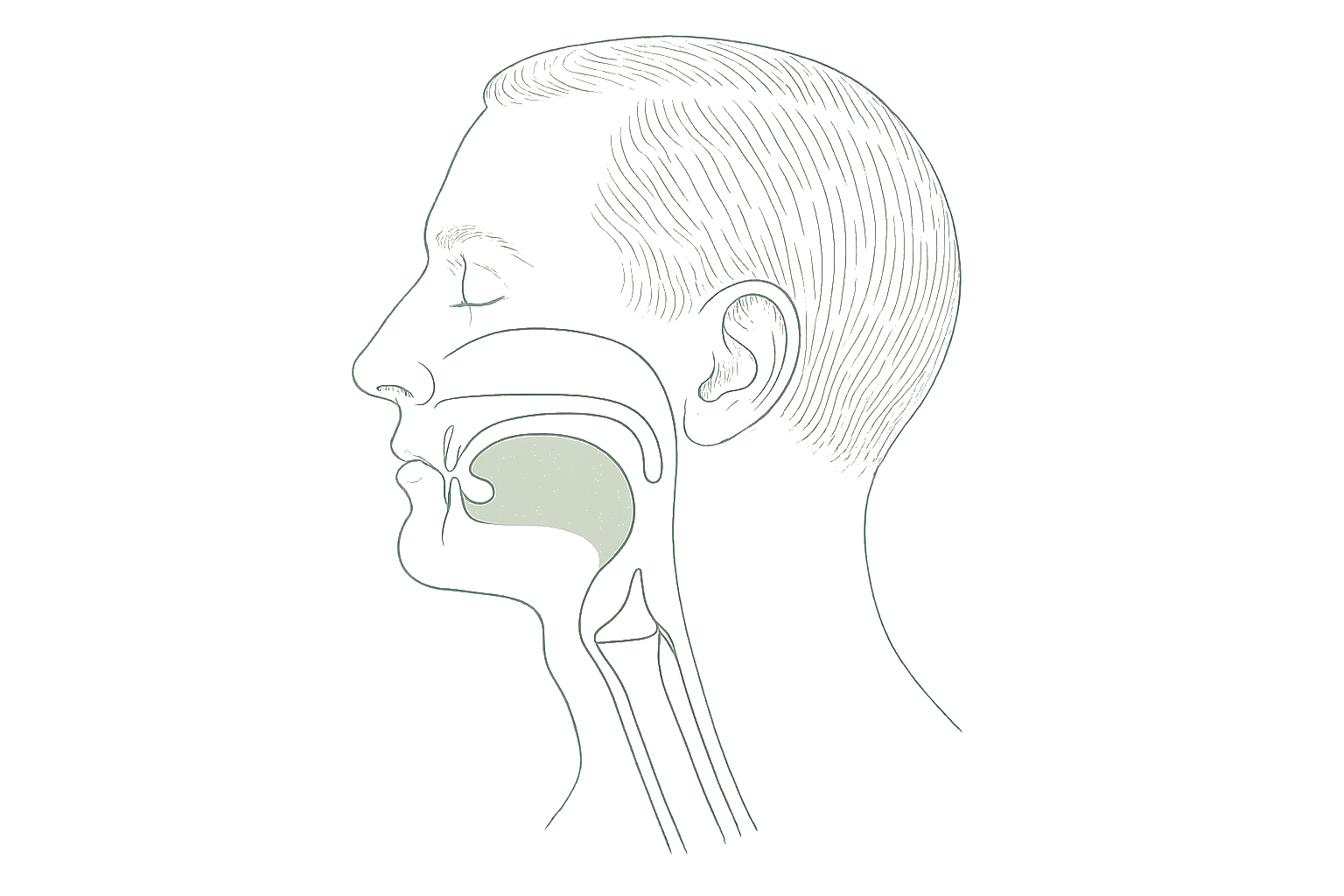 Editorial line illustration of a narrowed, obstructed airway