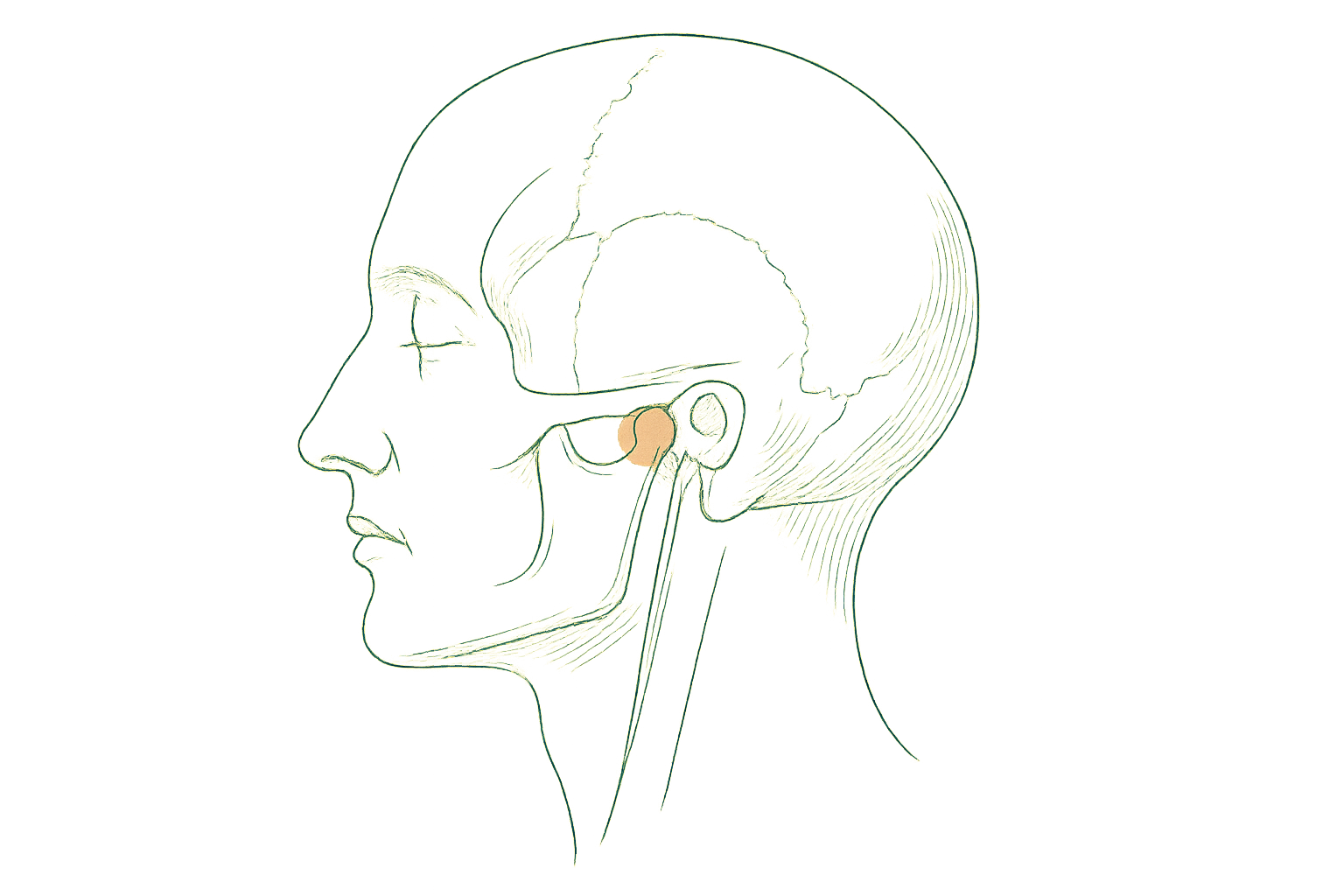 Editorial line illustration of the temporomandibular jaw joint