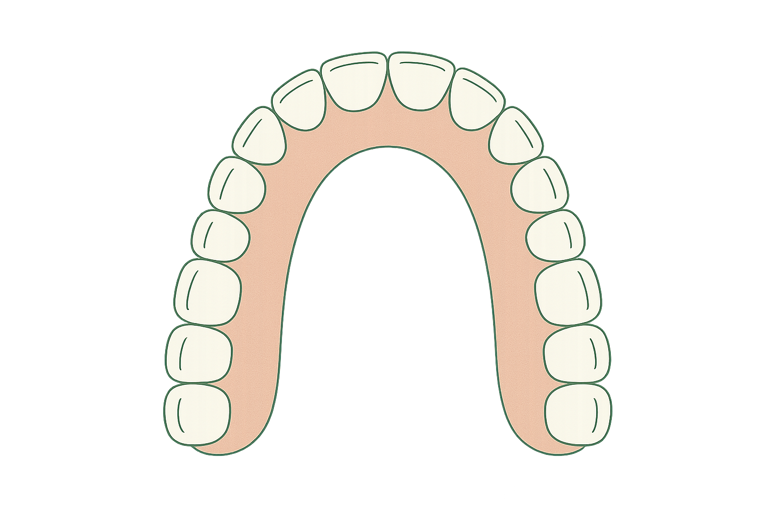 Line illustration of adult jaw expansion on the dental arch