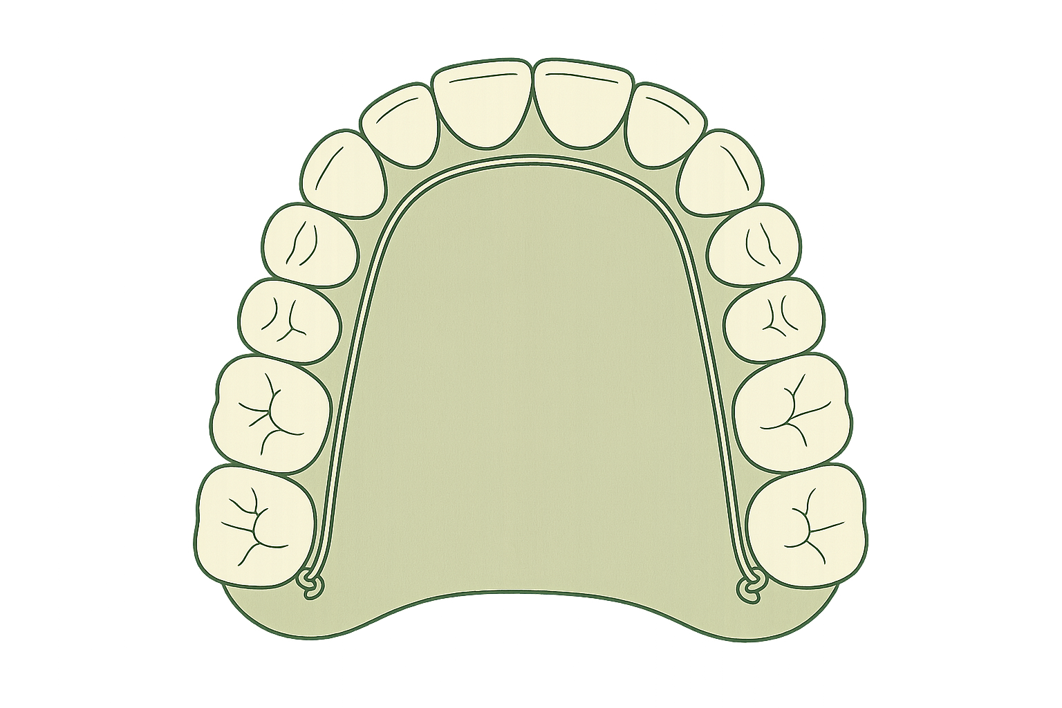 Line illustration of an ALF lightwire appliance on the dental arch
