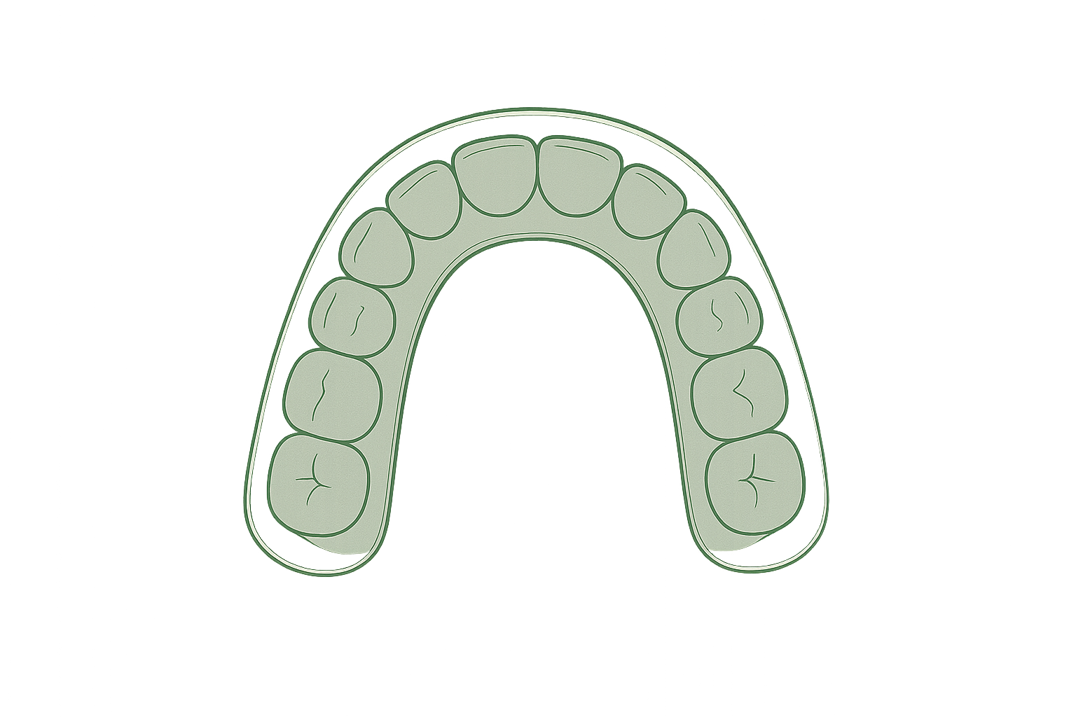 Line illustration of a clear aligner on the dental arch